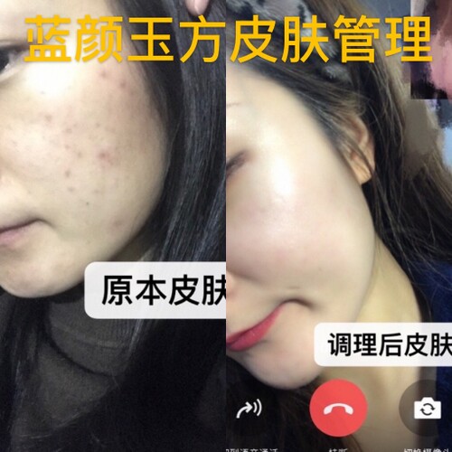 皮肤管理