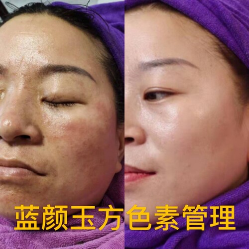 皮肤管理