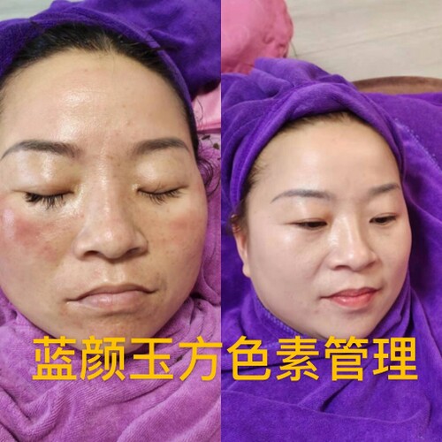 皮肤管理
