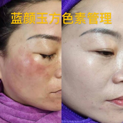 皮肤管理