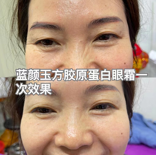胶原蛋白眼霜案例